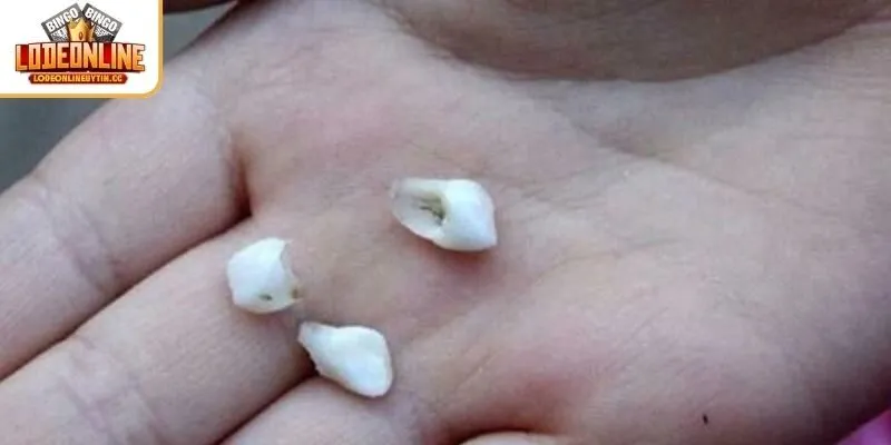 Giải mã chiêm bao rụng răng không chảy máu